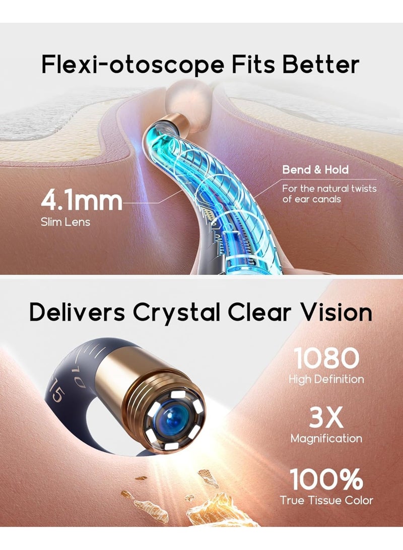 بيبيرد أداة إزالة شمع الأذن Earsight Plus I35R المزودة بكاميرا | منظف أذن ذكي مزود بملقط لطيف و12 طرفًا، منظار أذن عالي الدقة للبالغين والأطفال - Image 5